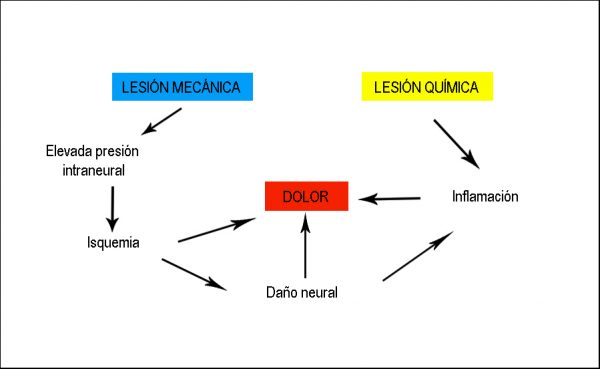 mecanismo dolor radiculopatía lumbar